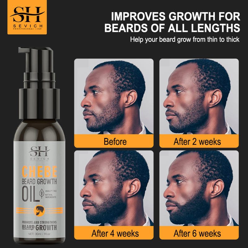 Hair Care Serum - Sevich Men Beard Growth Essential Chebe