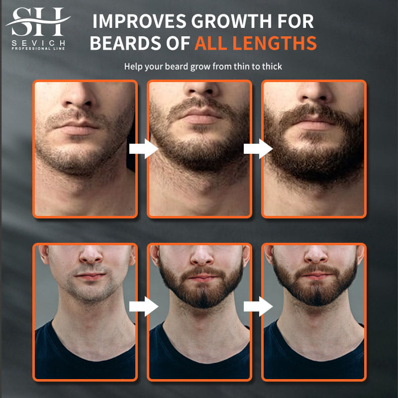 Sevich Men Beard Growth Essent - Hair Care Serum のレビューと価格