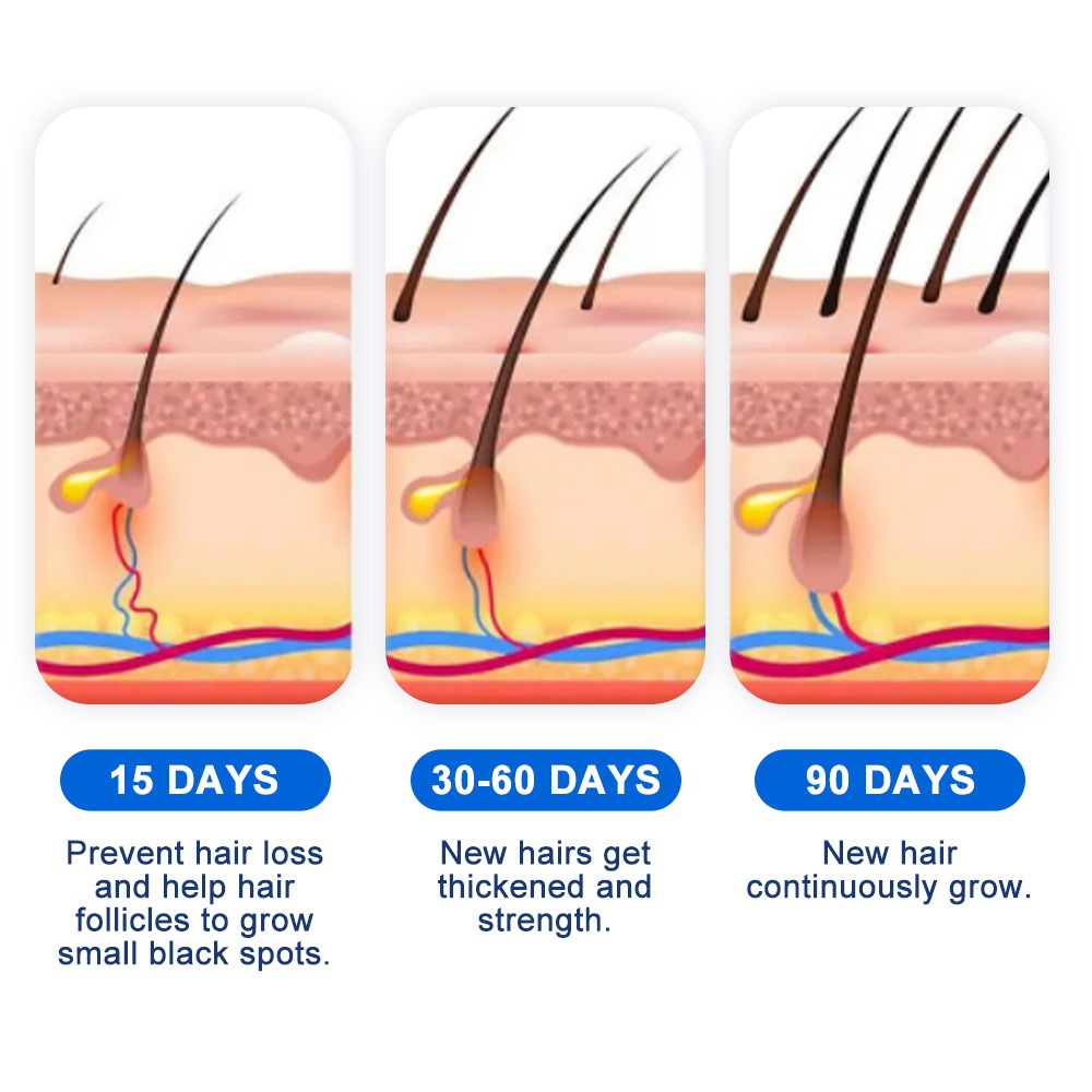 Alopecia Hair Growth Spray Sop - Hair Care Growth のレビューと価格