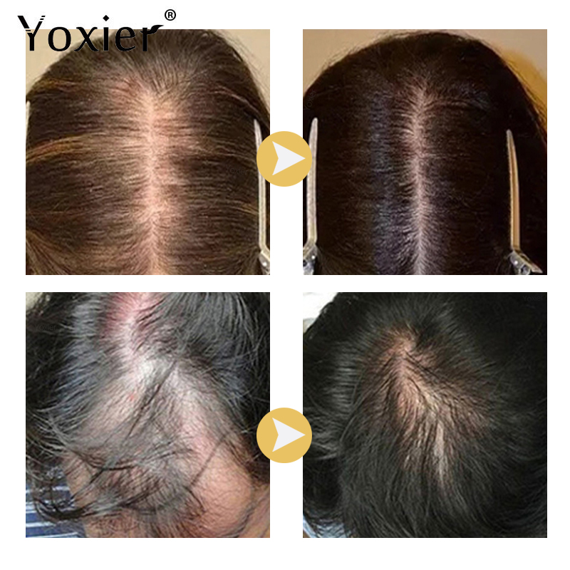 Intensive Growth Serum Prevent - Hair Care Growth のレビューと価格