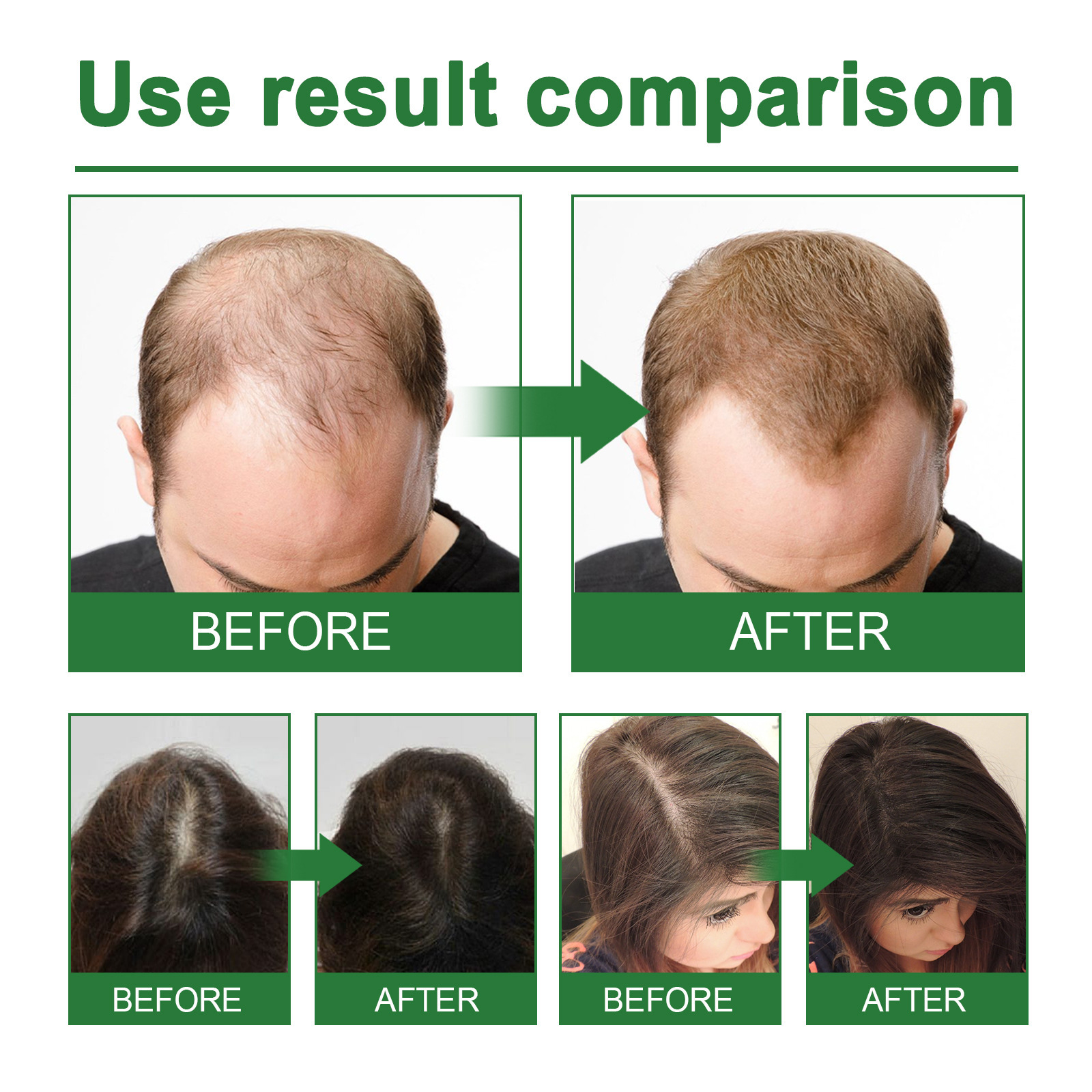 Rosemary Spray for Hair Nouris - Hair Care Naturally のレビューと価格